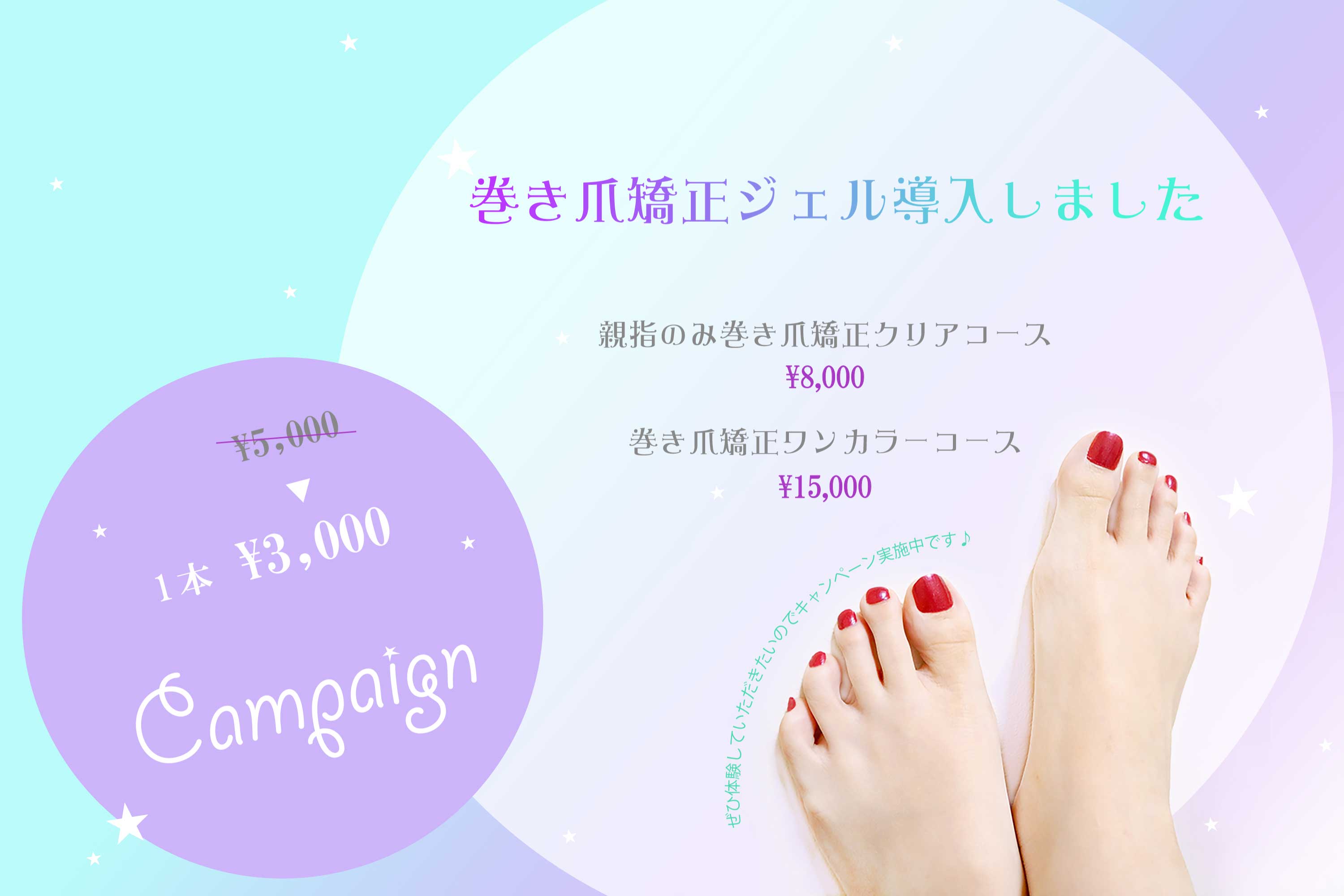 mainvisual3巻き爪矯正キャンペーン